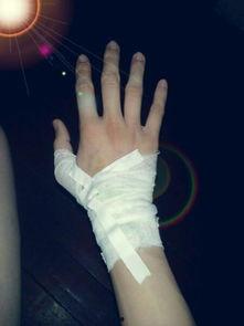 受伤照片真实,真实受伤瞬间，勇敢面对伤痛的瞬间记录