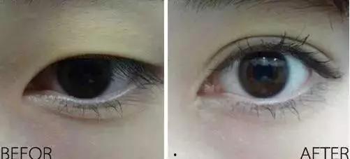 做双眼皮的明星,跟随这些偶像打造完美眼型